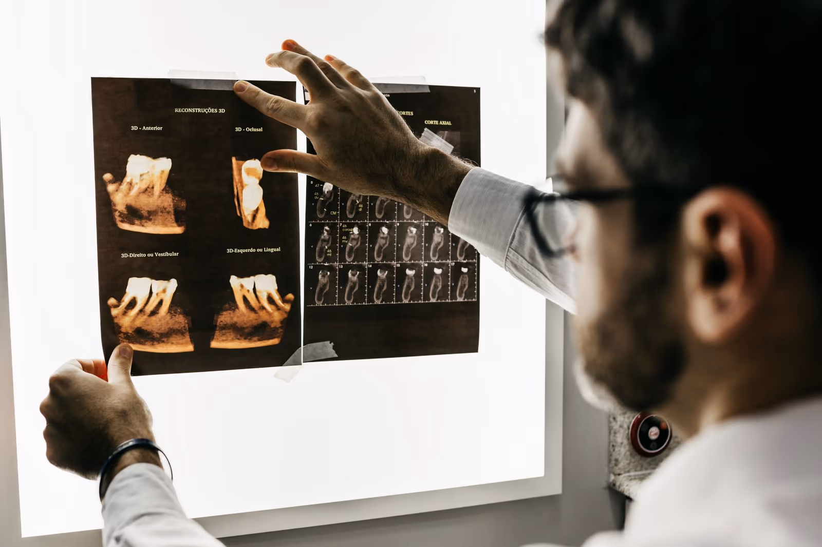 Dentista analisa contra a luz as imagens de uma tomografia dos dentes